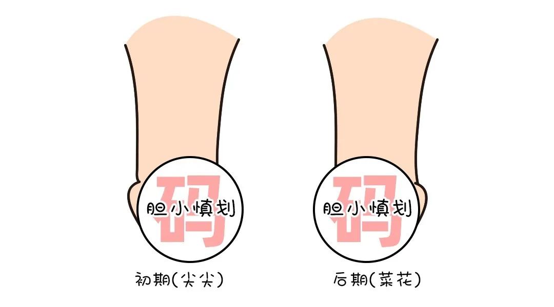 尖锐湿疣胆小慎划.jpg